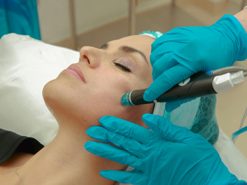 Harmonização Facial